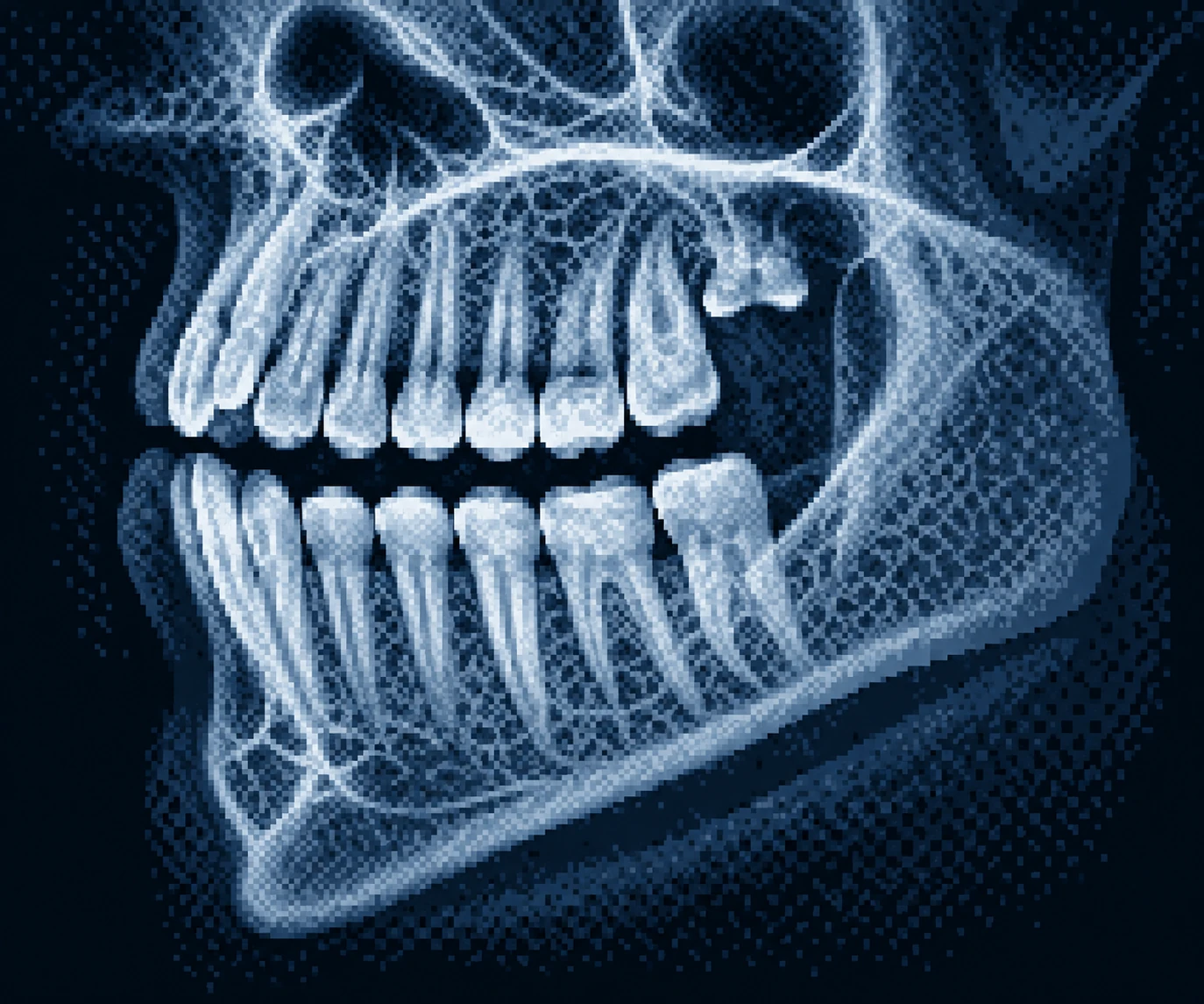 Jaw and teeth